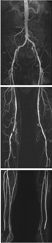 MRI image of the lower limbs. URVI (UDIAT)