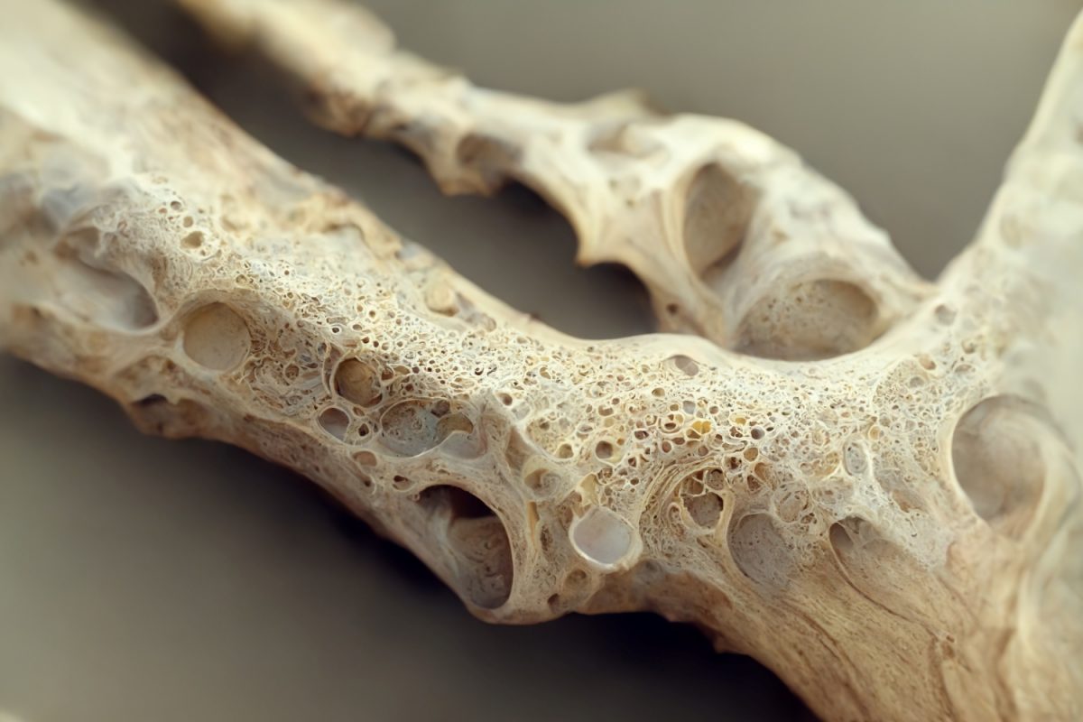 4ª edició del curs ‘4 tòpics en osteoporosi’
