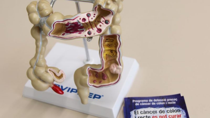 Dia Mundial Càncer de Còlon i recte