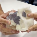 Cirurgia transorbital