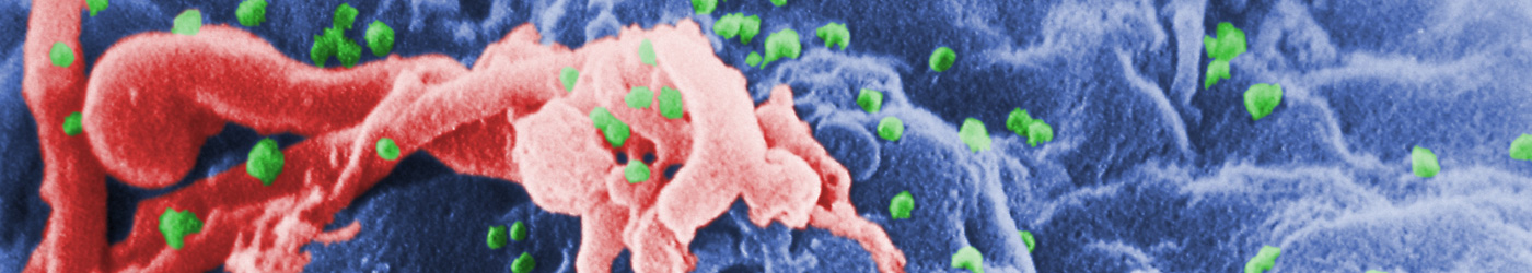 Microscopic image of HIV virions in green, assembling on the surface of a lymphocyte