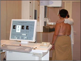 Image: How to do a mammogram